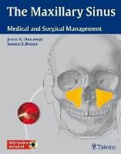 The Maxillary Sinus: Medical And Surgical Management [With 2 Dvds]