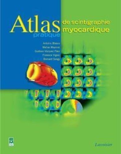Atlas De Scintigraphie Myocardique