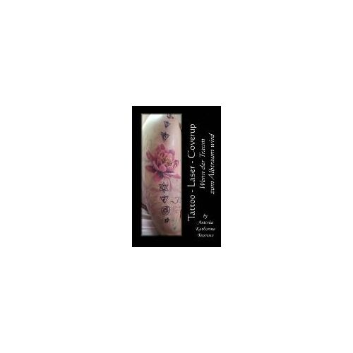 Tattoo - Laser - Cover Up