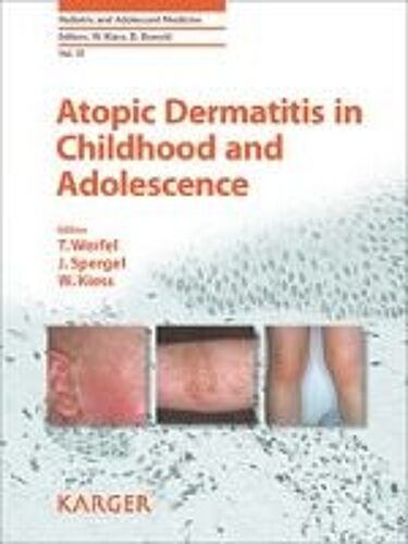 Atopic Dermatitis In Childhood And Adolescence