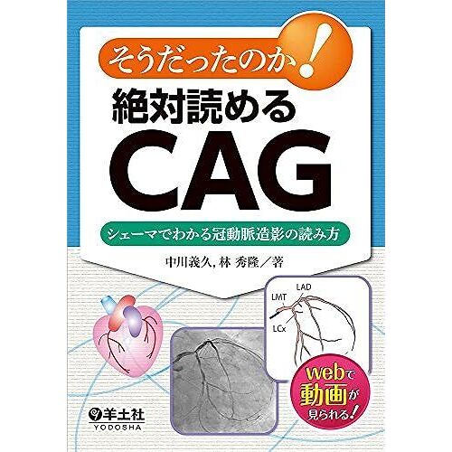 ! Cag