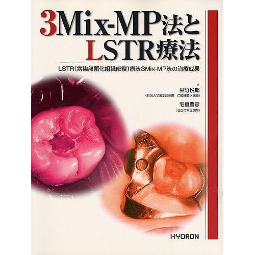 3mix-Mplstr: Lstr()3mix-Mp