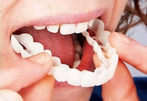 Prothèses Dentaires Fausses Dents Sourire Dents Top Fausses Dents Pour Les Femmes Et Les Hommes2pcswhite 