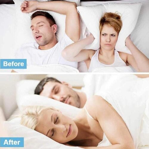 Spray Anti-Ronflement Pour Homme Et Femme, Nouveau Produit, 1 Pièce, Amélioration De La Qualité Du Sommeil, Offre Spéciale, J0b T6p1 