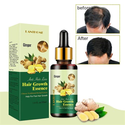 Soins Capillaires Cheveux Roux Cheveux Denses Pour Favoriser L'absorption Des Cheveux Solution Nutritive 30ml