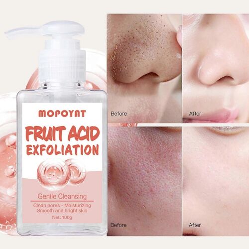 Gel Exfoliant Aux Fruits De Beauté, Hydratant Resserrant Les Pores, Blanchissant, Éclaircissant, Gel Exfoliant, Nettoyant Pour Le Visage 100g