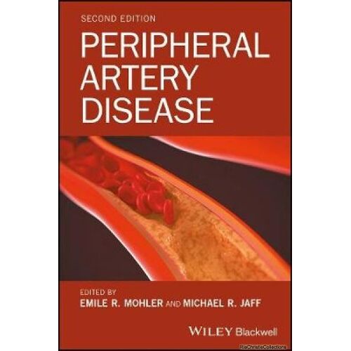 Peripheral Artery Disease