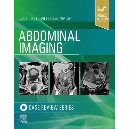 Abdominal Imaging