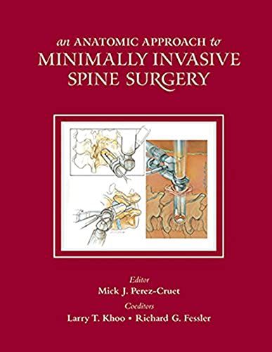 An Anatomic Approach To Minimally Invasive Spine Surgery
