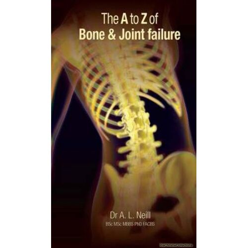 The A To Z Of Bone And Joint Failure