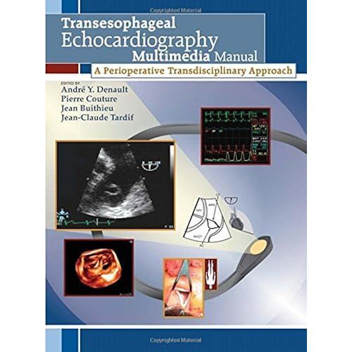 Transesophageal Echocardiography Multimedia Manual, First Edition: A Perioperative Transdisciplinary Approach (Book + Dvd)