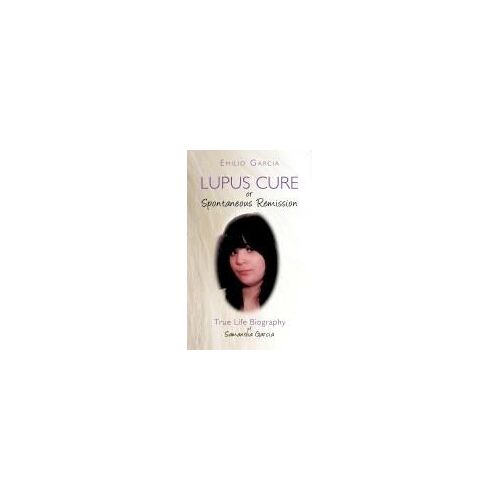 Lupus Cure Or Spontaneous Remission