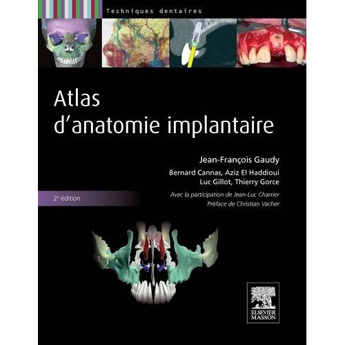 Atlas D'anatomie Implantaire