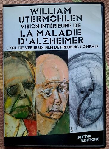 L'oeil De Verre - William Utermohlen, Vision Intérieure De La Maladie D'alzheimer.  Frédéric Compain. Dvd