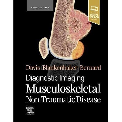 Diagnostic Imaging: Musculoskeletal Non-Traumatic Disease