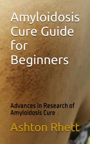 Amyloidosis Cure Guide For Beginners: Advances In Research Of Amyloidosis Cure