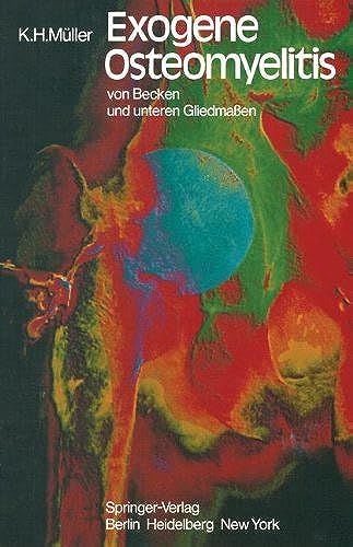 Exogene Osteomyelitis Von Becken Und Unteren Gliedmaßen: Besonderheiten Pathogenese Klinik Therapie Ergebnisse