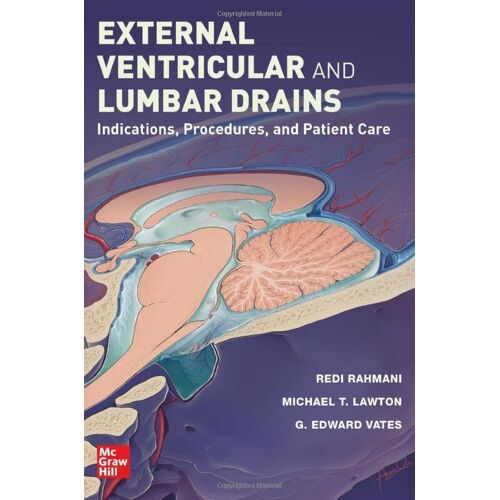 External Ventricular And Lumbar Drains: Indications, Procedures, And Patient Care