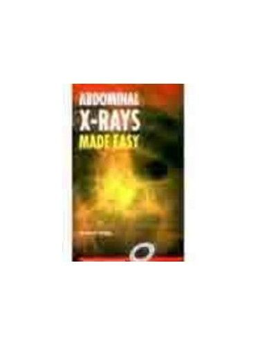 Begg Abdominal X-Ray Made Easy 1e Ise