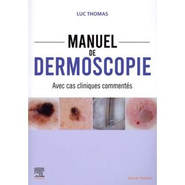 Manuel De Dermoscopie - Avec Cas Cliniques Commentés