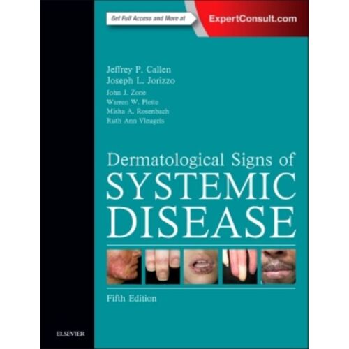 Dermatological Signs Of Systemic Disease
