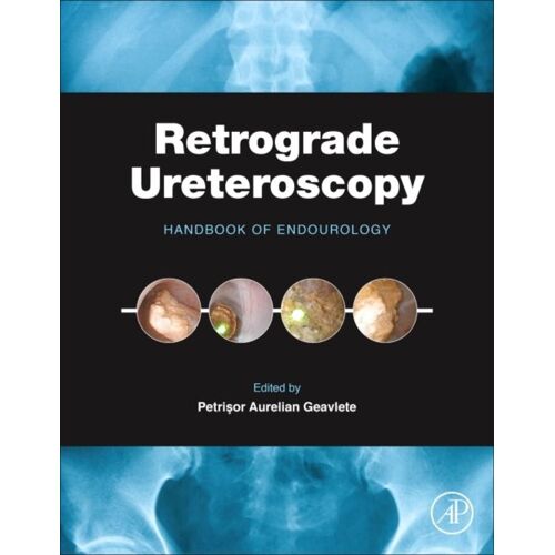 Retrograde Ureteroscopy