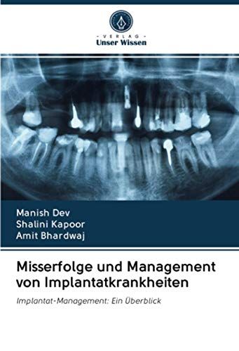 Misserfolge Und Management Von Implantatkrankheiten