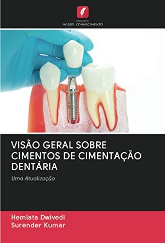 Visão Geral Sobre Cimentos De Cimentação Dentária