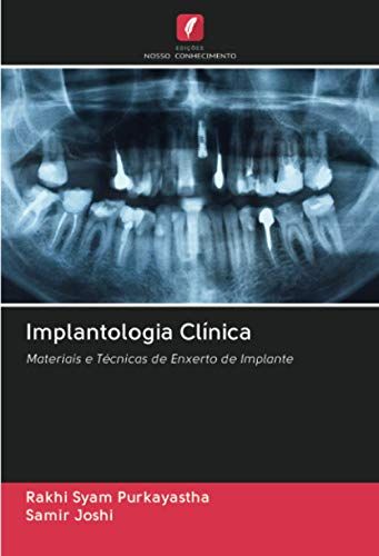 Implantologia Clínica
