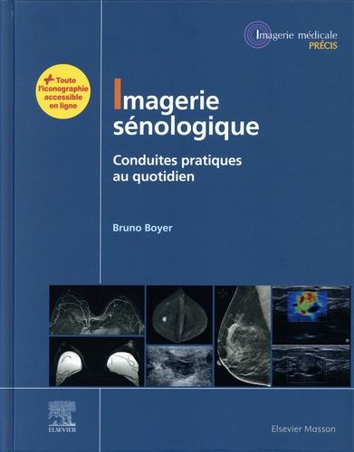 Imagerie Sénologique - Conduites Pratiques Au Quotidien