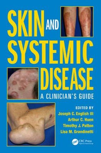 Skin And Systemic Disease