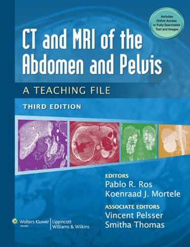 Ct & Mri Of The Abdomen And Pelvis