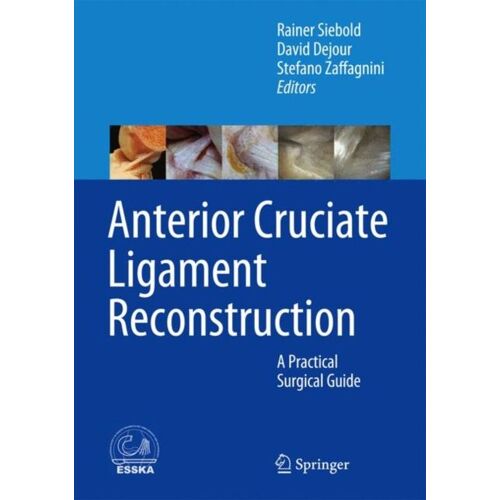 Anterior Cruciate Ligament Reconstruction: A Practical Surgical Guide (Hardcover)