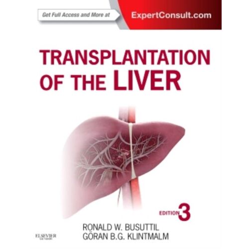 Transplantation Of The Liver