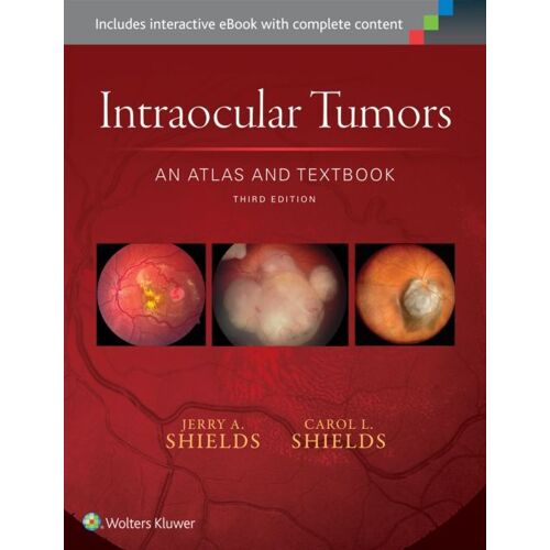 Intraocular Tumors: An Atlas And Textbook