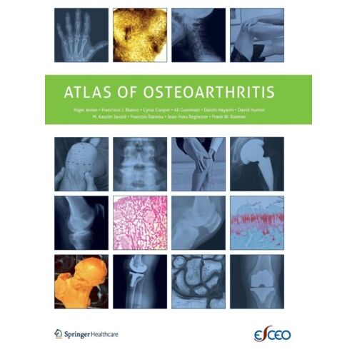Atlas Of Osteoarthritis