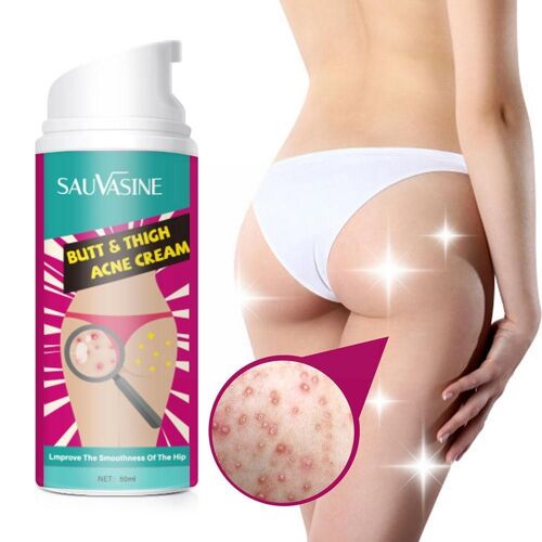 Crème De Traitement D'acné Pour Les Fesses Et Les Cuisses, 50ml, Élimine Les Boutons D'acné, Hydratant, Élimination Des Taches Foncées Des Cuisses, Lissage Du Corps, L H9k8 
