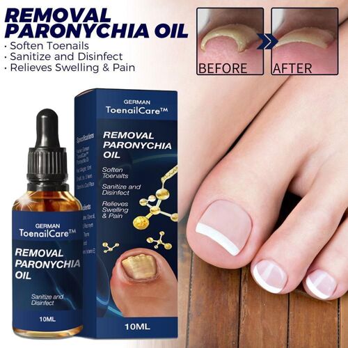 Sérum De Réparation Pour Les Ongles, 10ml, Traitement Antifongique, Soins Des Mains Et Des Pieds, Anti-Infection, S4u5 