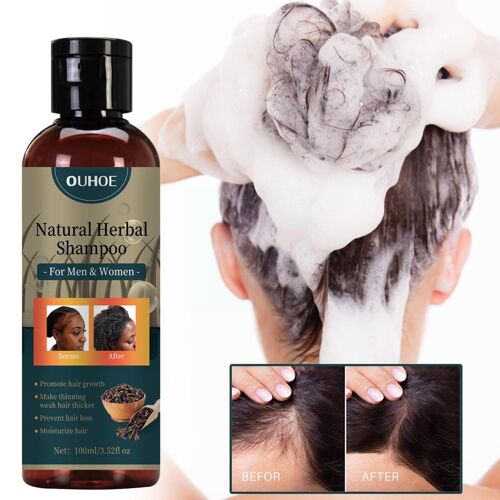 Shampoing Anti-Perte De Cheveux À Base De Plantes, 100ml, Anti-Amincissement, Favorise La Prévention De La Perte De Cheveux, Soins Épaississants, Gr K1g1 