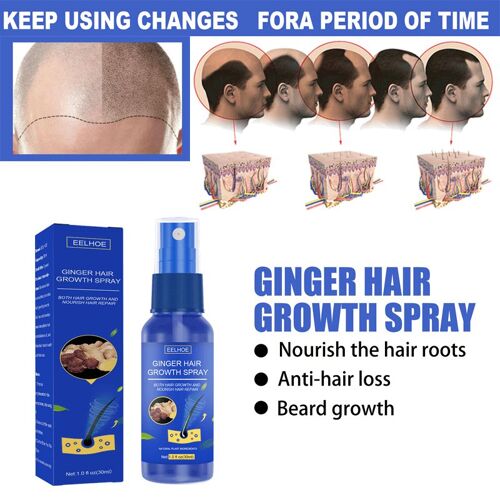 Sérum De Croissance Capillaire Au Gingembre, Produit De Traitement Anti-Perte De Cheveux, Soins Capillaires À Croissance Rapide, Huiles De Massage Réparatrices Nourrissantes Pour Le Cuir Chevelu 