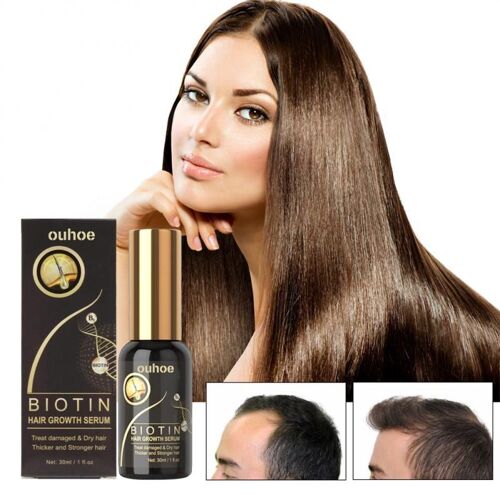 Essence Génératrice De Cheveux Extrait De Noix Enrichi Réparer Hydratant Les Follicules Pileux Endommagés, Favoriser La Croissance Des Cheveux, Prévenir La Perte De Cheveux 