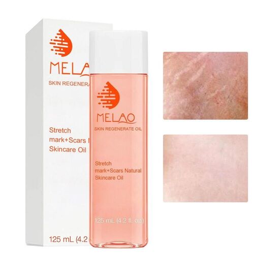 Huile De Massage Au Collagène Pour Le Corps, 125ml, Pour Les Bras, La Poitrine, Le Cou, Le Ventre, Les Cuisses, Les Fesses 