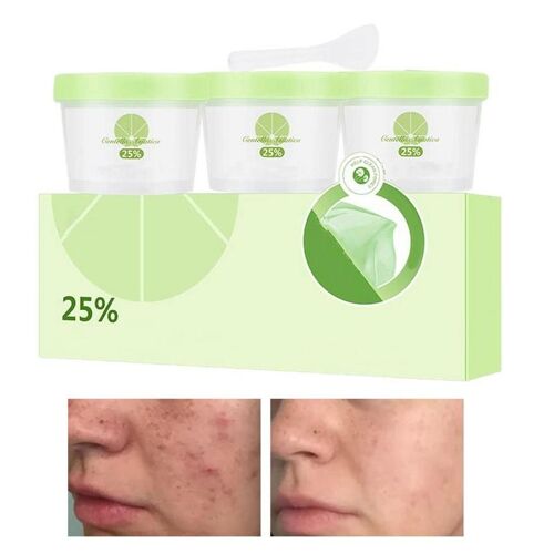 Poudre De Masque Doux Organique, 0.7oz, 3 Pièces, Hydratant Pour Le Visage, Acide Hyaluronique, Réduit L'hydratation 