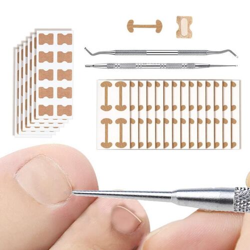 Bandes Correctrices Pour Ongles Incarnés, 60 Pièces, Patch Correcteur De Santé Pour Les Orteils, Y Compris Lime À Ongles Incarnés Et Élévateur, Patch Élastique Incurvé 
