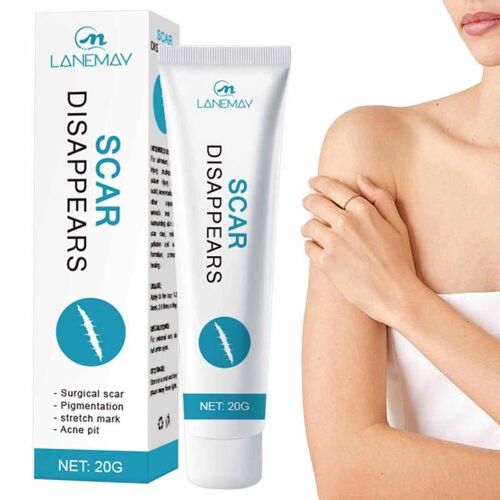 Crème Anti-Cicatrices, Soins Pour La Peau, Hydratant, Estompe Les Cicatrices, Pour Le Corps, Les Jambes, Les Bras, Les Anciennes Et Nouvelles Crèmes, Cadeau De Noël 