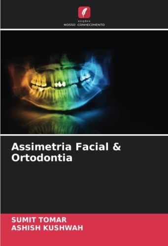 Assimetria Facial & Ortodontia