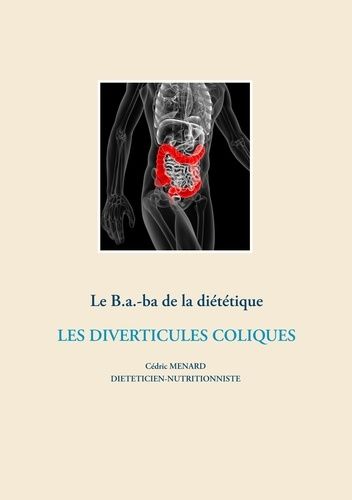 Le B.A.-Ba De La Diététique - Les Diverticules Coliques