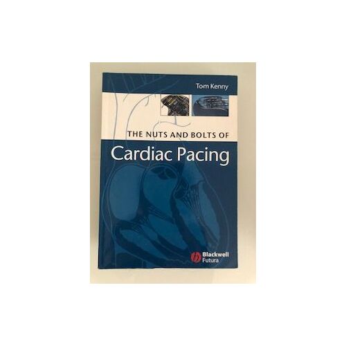 The Nuts And Bolts Of Cardiac Pacing