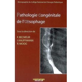 Pathologie Congénitale De L'oesophage