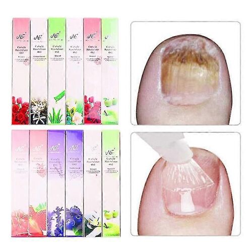 3 Ml Réparation D'ongles Stylo Liquide Avec Brosse Doux Anti Fongique Dissolvant Onychomycose Paronychie Pied Ongle Champignon Pour Ongles Manucure,